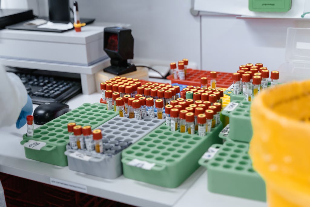 Misrethickulas Reddit Tube Blood samples in a lab, ready for testing and research. Organized for efficient processing.